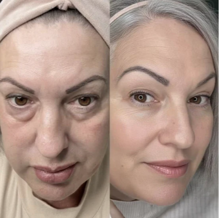 Skin&Collagen®-Bálsamo Coreano de Colágeno 1+1 GRATIS