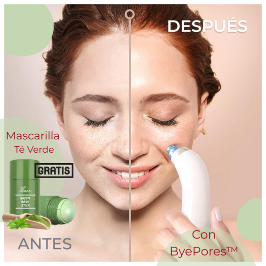 ByePores™ - Limpiador de Poros Profesional