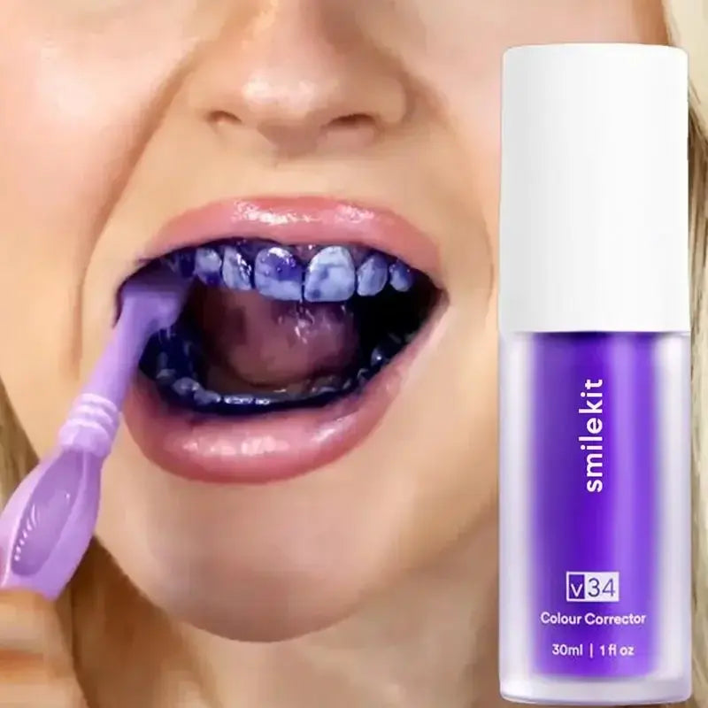 SMILEKIT®-Blanqueador dental
